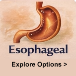 Esophageal cancer watercolor illustration