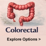 Metastatic Colorectal Cancer