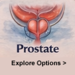 Metastatic Prostate Cancer