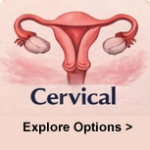 Cervical Cancer