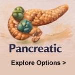 Metastatic Pancreatic Cancer